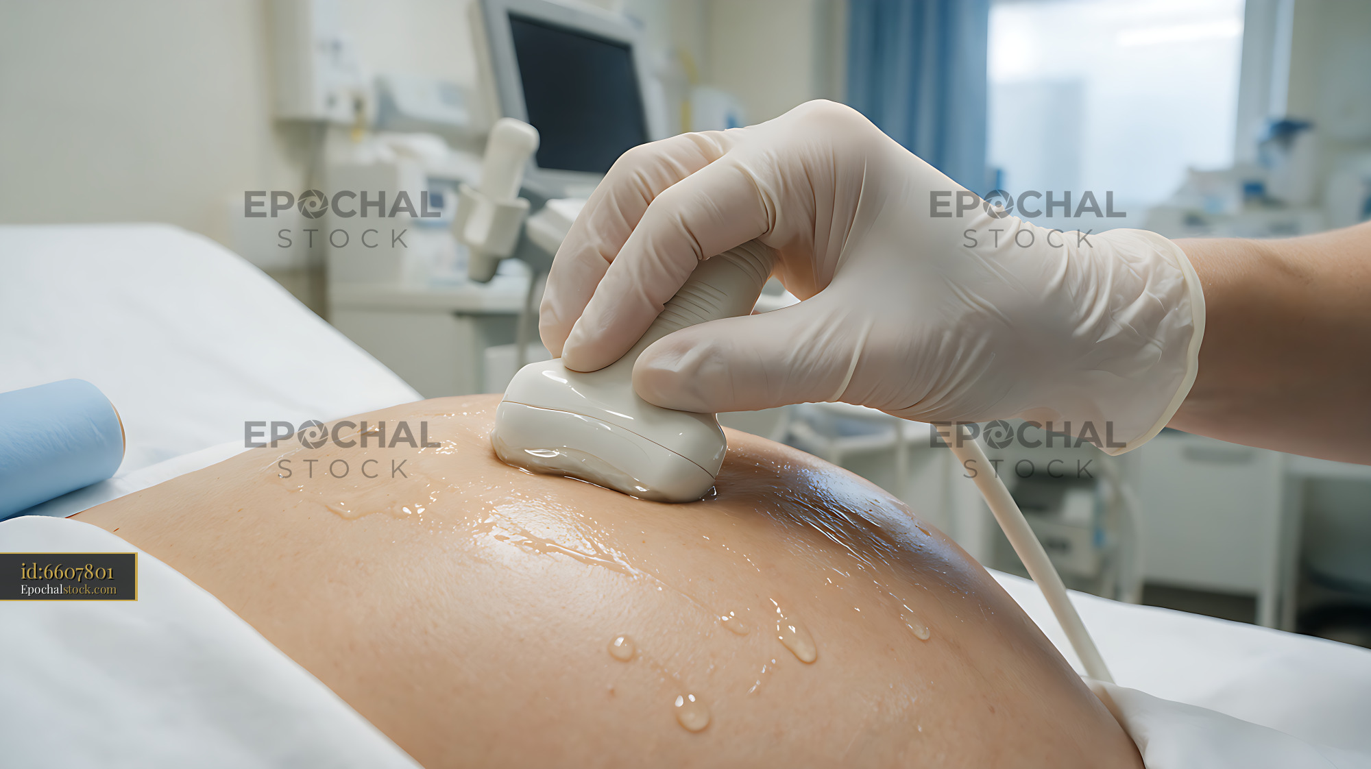 Watermarked full-resolution preview of Gloved sonographer using an ultrasound transducer