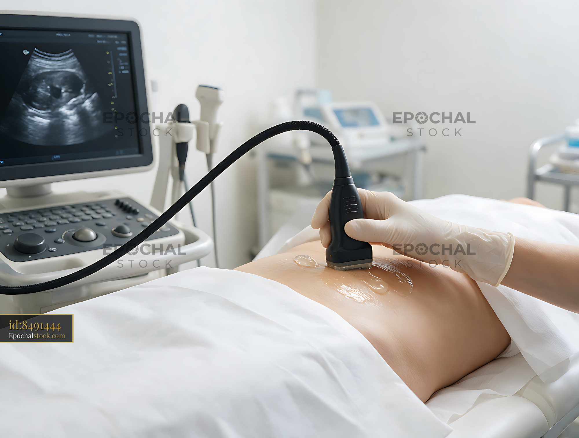 Watermarked full-resolution preview of Ultrasound transducer scanning a patient in a clinic